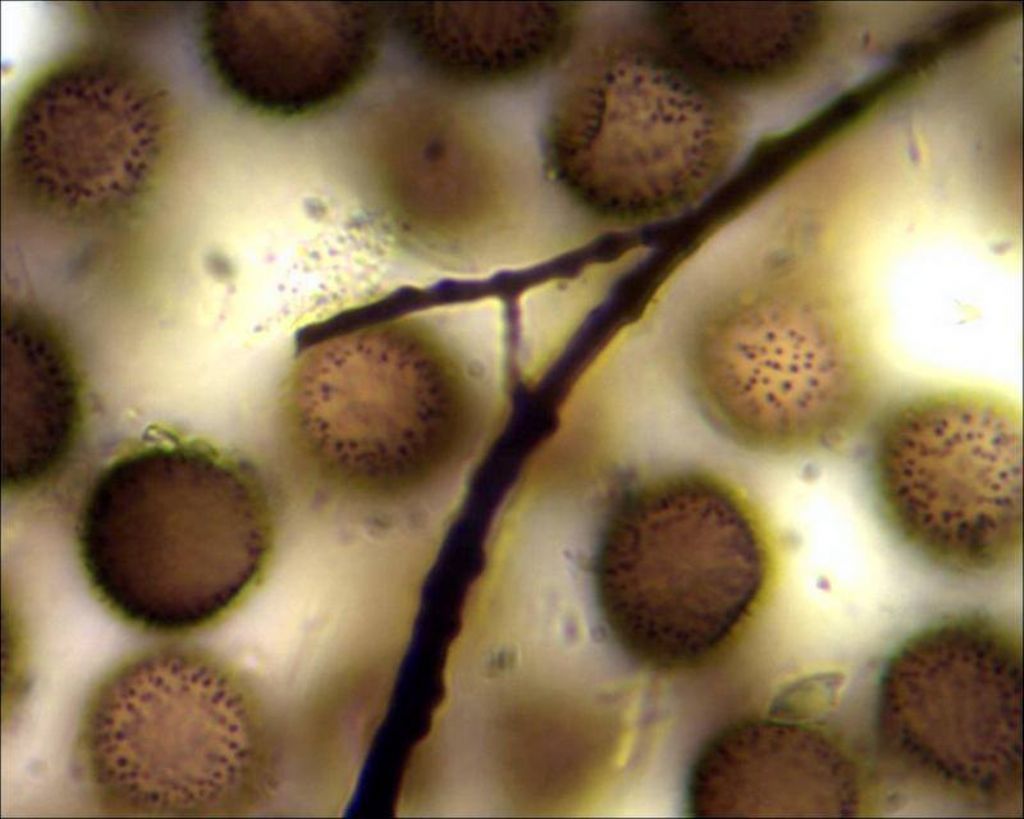 Sconosciuto myxo nivicolous da Olympos